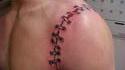 Tatouage bras recousu