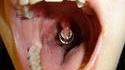 Piercing de l'extrême