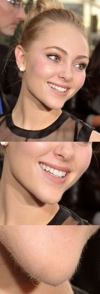Barbe de fille