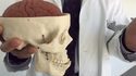 Votre cerveau quand vous vous cognez la tête