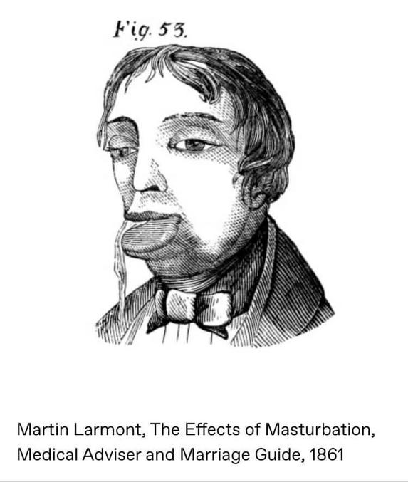 Cette image n'est rien par rapport aux élucubrations d'un gland patenté : https://www.demotivateur.fr/article/le-livre-sans-titre-publie-en-1830-decrivait-les-dangers-fatals-de-la-masturbation-dessins-a-l-appui-8334