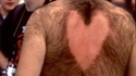 Coeur poilu