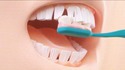Dents à brosses